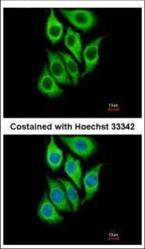 SERPINB3 Antibody in Immunocytochemistry (ICC/IF)