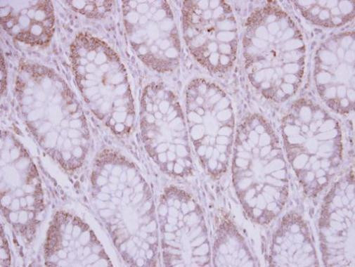 SFRP5 Antibody in Immunohistochemistry (Paraffin) (IHC (P))