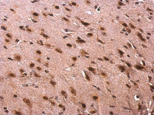 SFRS10 Antibody in Immunohistochemistry (Paraffin) (IHC (P))