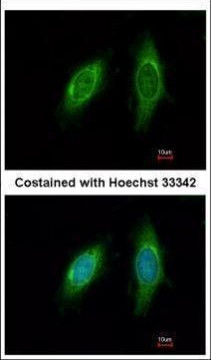 SGTA Antibody in Immunocytochemistry (ICC/IF)