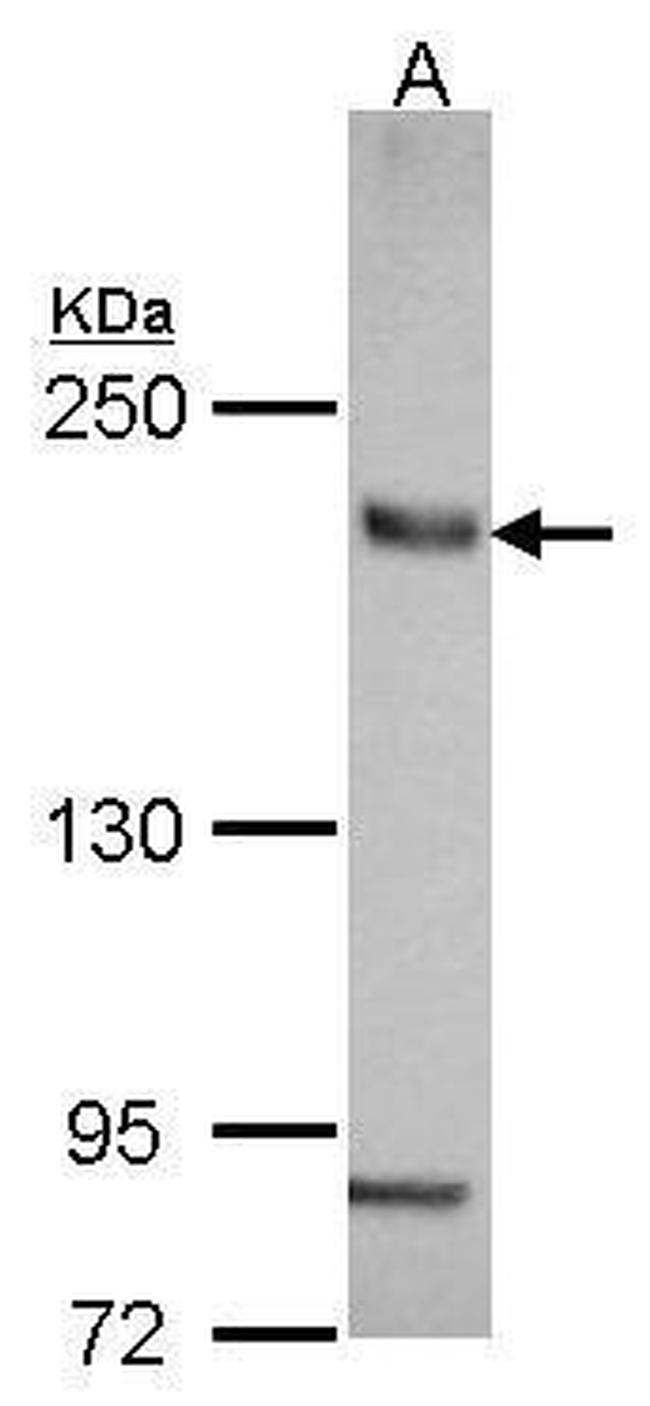 SLC4A2 Antibody in Western Blot (WB)