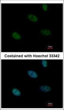 HLTF Antibody in Immunocytochemistry (ICC/IF)