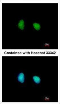 SMARCD1 Antibody in Immunocytochemistry (ICC/IF)