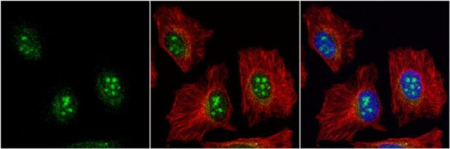 BAF57 Antibody in Immunocytochemistry (ICC/IF)