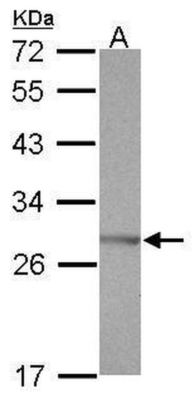SSX5 Antibody in Western Blot (WB)