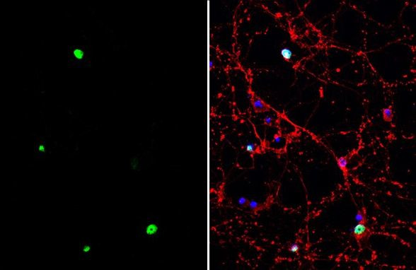 TLE4 Antibody in Immunocytochemistry (ICC/IF)