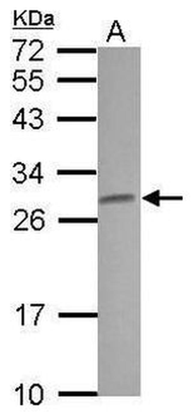Claudin 5 Antibody in Western Blot (WB)