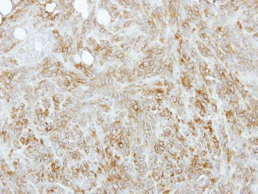 TPM4 Antibody in Immunohistochemistry (Paraffin) (IHC (P))