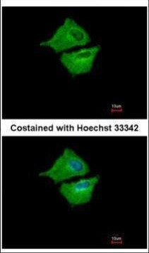UBE2G1 Antibody in Immunocytochemistry (ICC/IF)