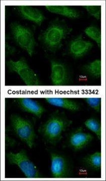 UBE2L3 Antibody in Immunocytochemistry (ICC/IF)