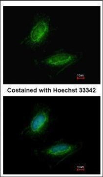 UMPS Antibody in Immunocytochemistry (ICC/IF)