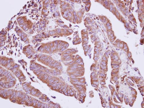 Coronin 2A Antibody in Immunohistochemistry (Paraffin) (IHC (P))