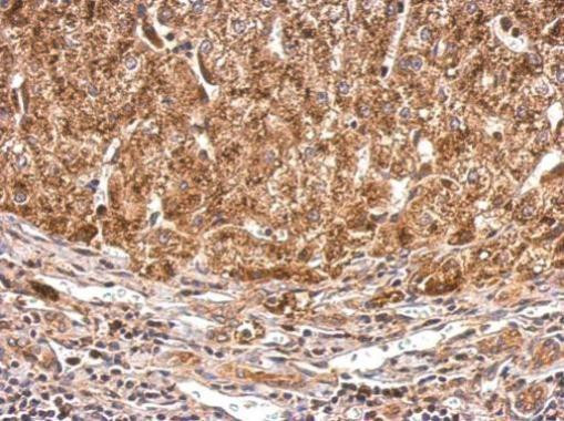 PEX5 Antibody in Immunohistochemistry (Paraffin) (IHC (P))