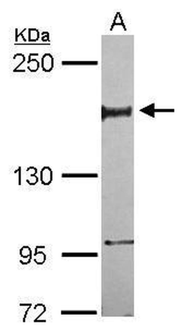 NFRKB Antibody in Western Blot (WB)