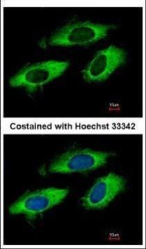 RPL6 Antibody in Immunocytochemistry (ICC/IF)