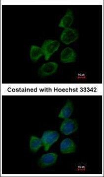 Aldolase B Antibody in Immunocytochemistry (ICC/IF)