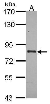 ABCB7 Antibody in Western Blot (WB)