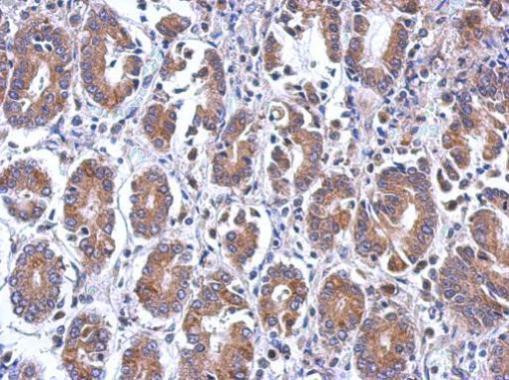 eIF5 Antibody in Immunohistochemistry (Paraffin) (IHC (P))