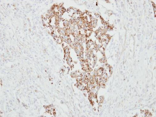 RARRES1 Antibody in Immunohistochemistry (Paraffin) (IHC (P))