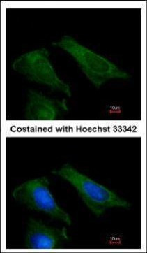 TIMP4 Antibody in Immunocytochemistry (ICC/IF)