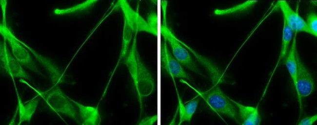 TALDO1 Antibody in Immunocytochemistry (ICC/IF)