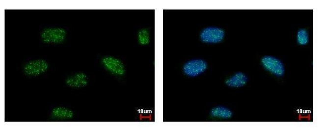 SMARCD1 Antibody in Immunocytochemistry (ICC/IF)
