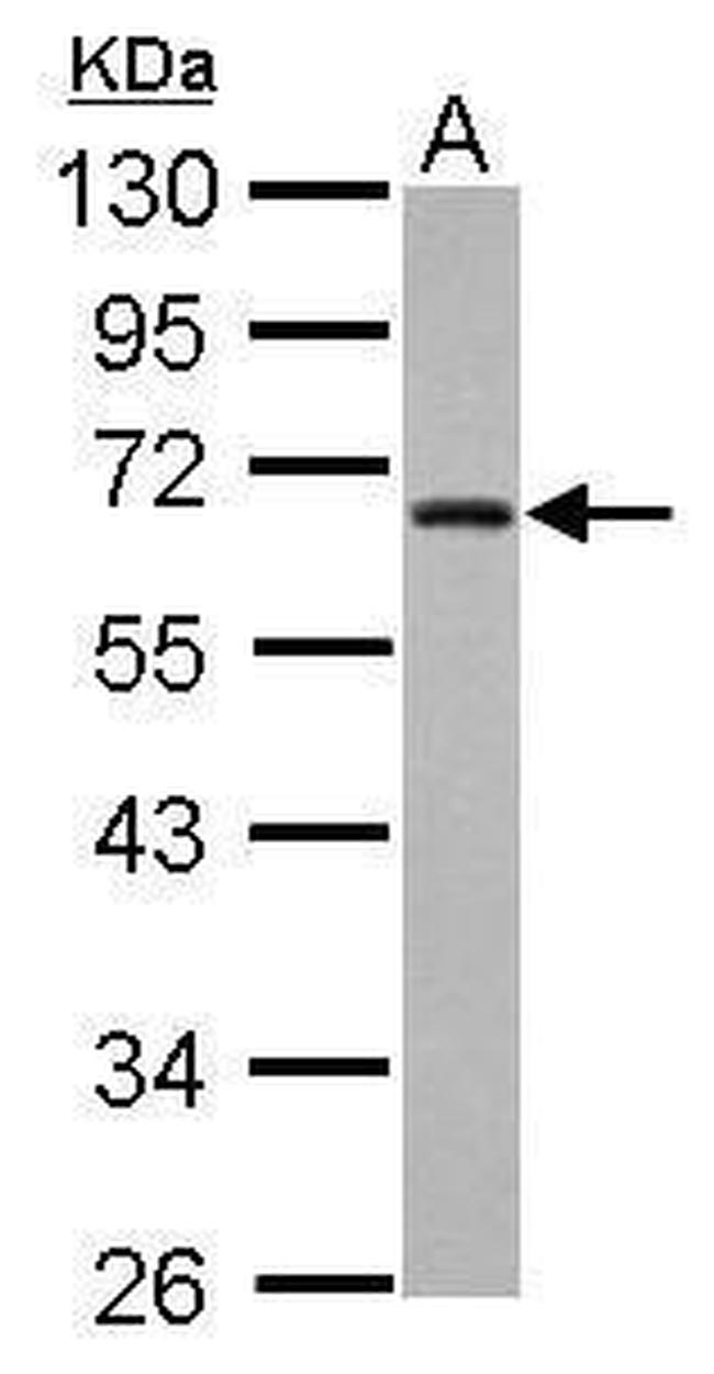 ZNF215 Antibody in Western Blot (WB)