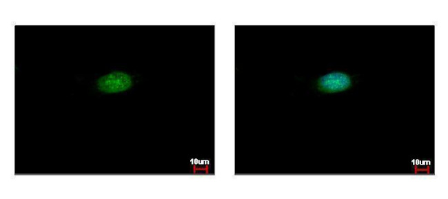 CSTF2 Antibody in Immunocytochemistry (ICC/IF)