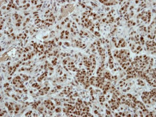 ZNF187 Antibody in Immunohistochemistry (Paraffin) (IHC (P))