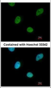 CNOT3 Antibody in Immunocytochemistry (ICC/IF)