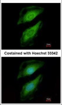 PLCD1 Antibody in Immunocytochemistry (ICC/IF)
