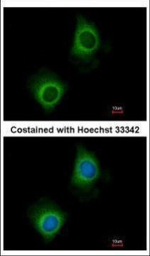 VARS Antibody in Immunocytochemistry (ICC/IF)