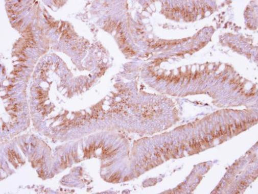 COX15 Antibody in Immunohistochemistry (Paraffin) (IHC (P))
