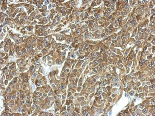 TPD52 Antibody in Immunohistochemistry (Paraffin) (IHC (P))