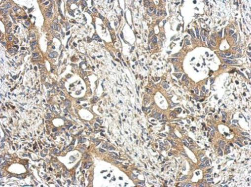 STAM Antibody in Immunohistochemistry (Paraffin) (IHC (P))
