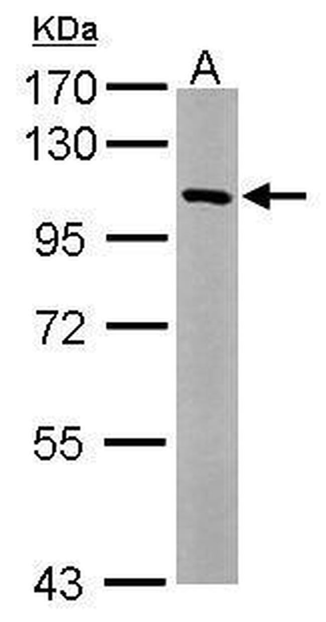 USP5 Antibody in Western Blot (WB)