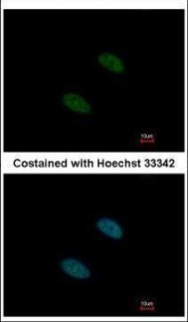 SF3A2 Antibody in Immunocytochemistry (ICC/IF)