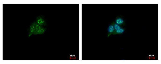 HDHD1 Antibody in Immunocytochemistry (ICC/IF)