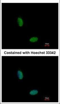 RBM10 Antibody in Immunocytochemistry (ICC/IF)