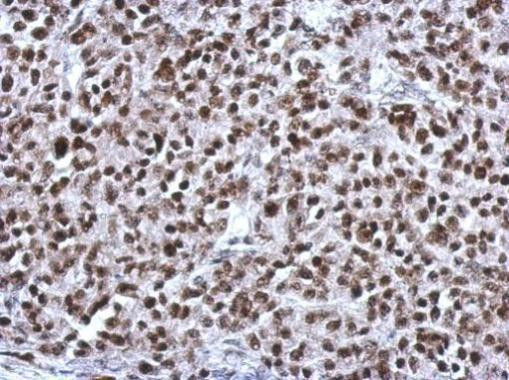 CGGBP1 Antibody in Immunohistochemistry (Paraffin) (IHC (P))