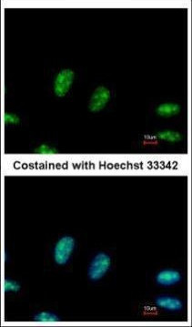 RRP1 Antibody in Immunocytochemistry (ICC/IF)