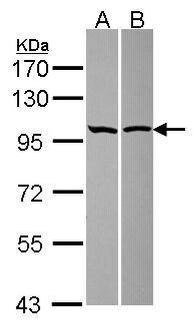 ASAP2 Antibody in Western Blot (WB)