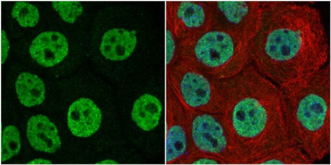 FUBP1 Antibody in Immunocytochemistry (ICC/IF)