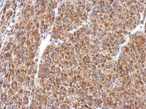 PIAS2 Antibody in Immunohistochemistry (Paraffin) (IHC (P))