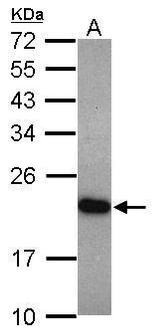 UNC119 Antibody in Western Blot (WB)