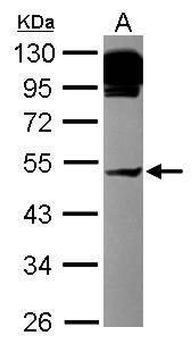 AP4M1 Antibody in Western Blot (WB)