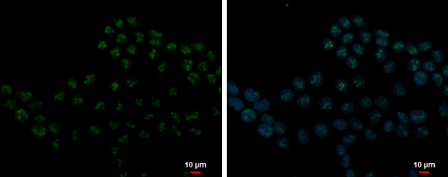 DDX21 Antibody in Immunocytochemistry (ICC/IF)