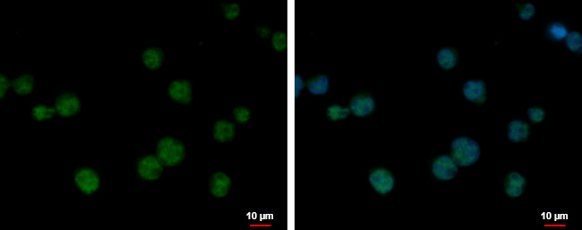 BCL7C Antibody in Immunocytochemistry (ICC/IF)