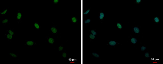 DDX23 Antibody in Immunocytochemistry (ICC/IF)