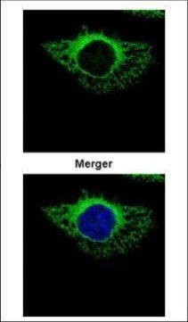 ERP72 Antibody in Immunocytochemistry (ICC/IF)